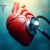 Angina – co warto wiedzieć o objawach, przyczynach i leczeniu?
